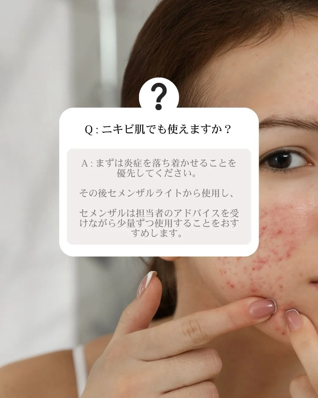 「セメンザルライトと何が違うの?」