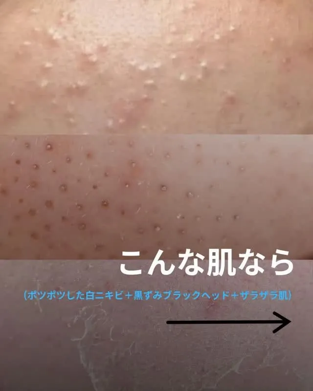 するしかない‼️