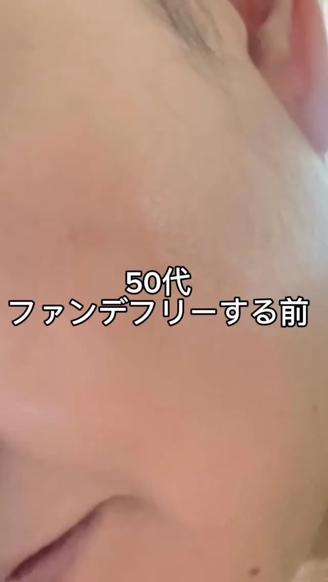 50代になると増えてくる肌悩み…